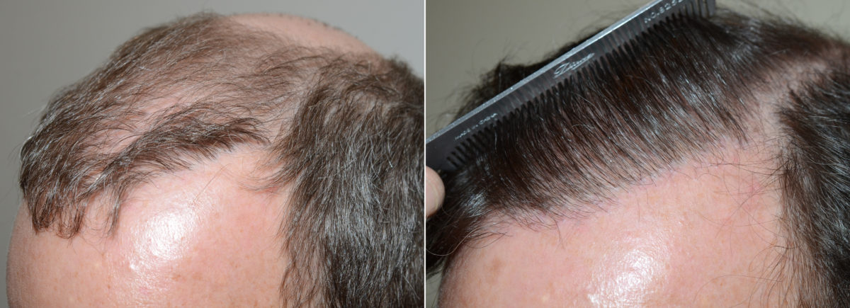 Reparative Photos - Foundation For Hair Restoration